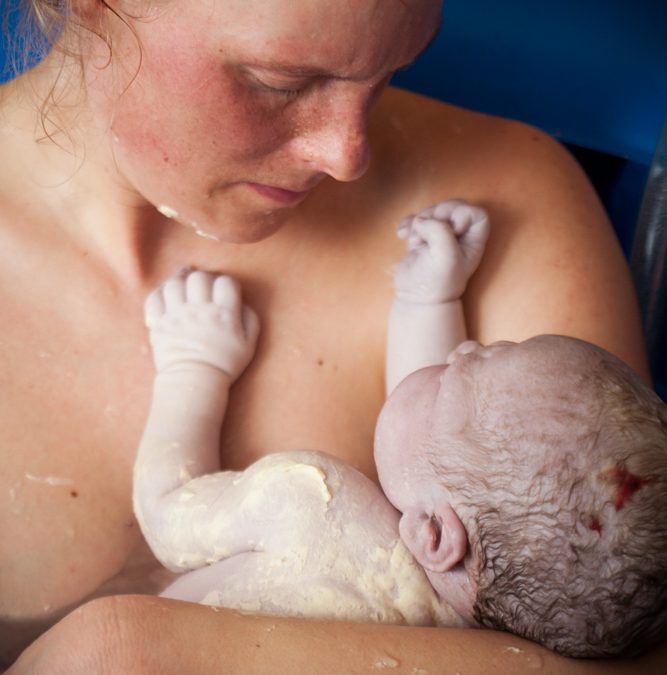 Petitie: Kies voor vrije keus rondom bevallen